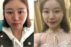 开眼角过大反面教材：少女感不再、脸比例失衡、说不出的奇怪图片