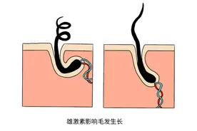 男人荷尔蒙充足，大多有3个特征，对照看看若你都有，偷着乐吧图片
