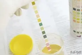 尿常规化验单的+号看不懂？不知道怎么回事？医生为你一次说清楚图片