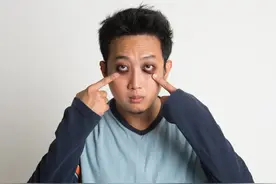 【答个疑】熬夜多严重会导致黑眼圈？图片