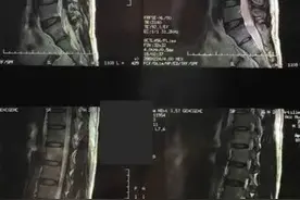 不一样的腿麻 不一样的思路图片