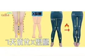 腿不直怎么办？美腿训练，教你改善X型腿图片