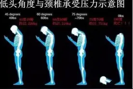 生命汇国际整合医疗10个锻炼方式缓解颈椎压力图片