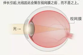 运动与健康 | 运动——近视预防的一剂良方图片