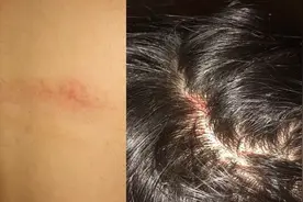 UBC亚裔学生遭种族歧视攻击血溅当场 现场人袖手旁观图片