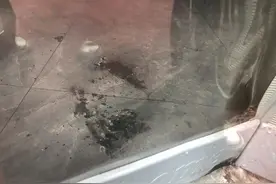 遭泼汽油烧伤女子曾帮男友还车贷，怕母亲担心，筹款时假称厨房着火图片