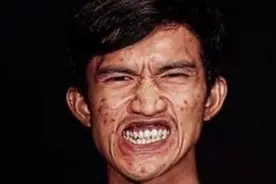 小伙天生面部歪丑不愿见人，整容后帅气无比，连亲妈都不敢认他了图片