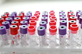 白俄罗斯新增198例新冠肺炎确诊病例 累计确诊74173例图片