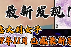 最新发现！意大利一女子2019年11月已感染新冠图片