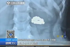 5岁男童腹痛呕吐，家人送医治疗，医院拍片一看吓一跳视频封面