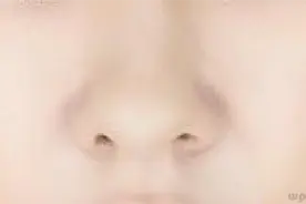 鼻子上挤出白色颗粒？闻起来有点臭，医生告诉你怎样去除图片
