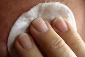 皮肤病是你吃出来的！皮肤病患者的饮食禁忌：少碰这5种图片