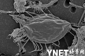 加拿大研究生在徒步时发现新型微生物 系真核生物第五届图片