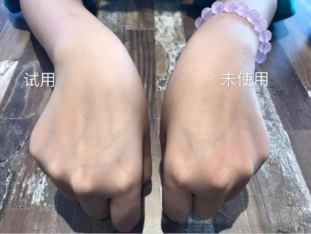澳洲胶原蛋白液的功效与作用 2026年澳洲胶原蛋白液的功效与作用及副作