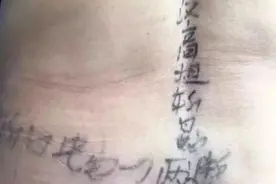 腰上长了一圈这个，邻居看到后竟然做出这么诡异地事情，20天后……图片