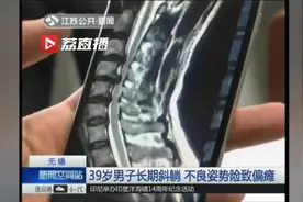 吓哭！每天歪在沙发上玩手机，男子脊髓只剩一条线！差点偏瘫……视频封面