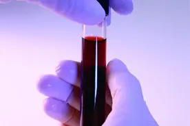 如何正确解读血检报告中的PSA值？视频封面