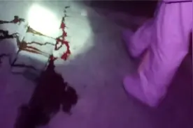 诡异塑料袋漏血水，家门口血流满地，女子凌晨报警称“有人抛尸”视频封面