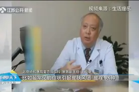 喝酒脸红，吃羊肉长痘痘······这些其实都不是食物过敏视频封面