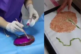 胎盘作画，护士绘“生命树”送新生儿父母视频封面