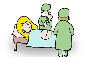 女性生产，顺产好还是剖腹产好？其中的利弊你都清楚吗？图片
