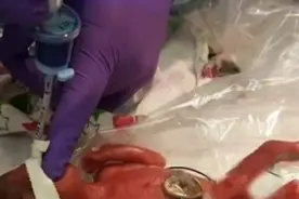 世界存活最小婴儿诞生！23周出生的她只有一个小苹果那么大！图片