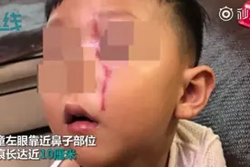 3岁男童电梯内被狗抓伤 狗主人称牵了绳被监控“打脸”视频封面
