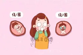 为什么胎儿会脐带绕颈？一般由3个因素导致，你占了其中几个？图片