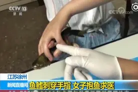 女子被鱼鳍刺穿手指后抱鱼求医，医生：做得对视频封面