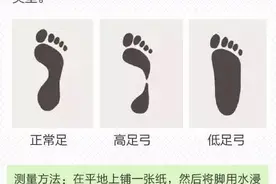 鞋合不合适，只有脚知道！那么如何选择适合自己的跑鞋呢？图片