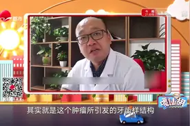 山东13岁女生嘴里清出100多颗牙，医生却说不是罕见病，咋回事？视频封面