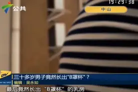 32岁男子患乳腺增生 长出“B罩杯”医生：油炸食品吃多了图片