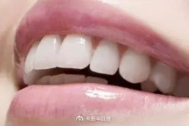 矫正一口牙最高要花十几万，消费者：我好难啊图片