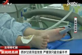 【五哥帮忙团】四岁女孩牙齿发黑 严重到只能全麻手术视频封面