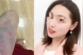 女教师坠亡被指遭家暴，警方：自杀不立案视频封面