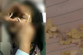 专家谈女童被塞纸片：心理影响或大于病理视频封面