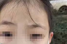 女童眼睛被塞纸疑云：无法用科学解释的“恶作剧”图片
