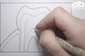 牙釉质从何而来视频封面