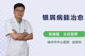 银屑病能治愈吗