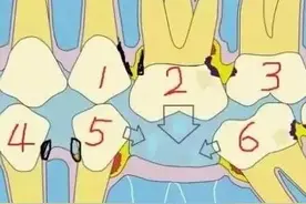 缺一颗牙，等于丢了三颗牙？图片