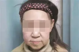 15岁少女长了一张60岁的脸：一直有个“变美”的梦图片