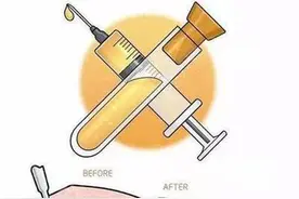 女人为何比男人更容易出现大粗腿？图片
