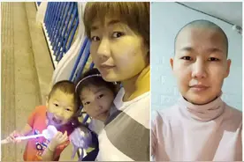 85后女护士剃了光头，只为更好地战斗图片