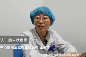 疼死人的带状疱疹：多数人感染过这种病毒，但20%人才会发病视频封面