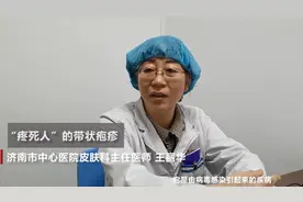 疼死人的带状疱疹：多数人感染过这种病毒，但20%人才会发病视频封面