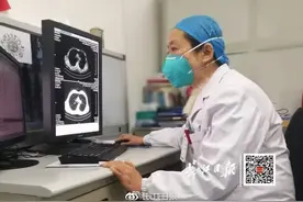 我告诉自己不要流泪，眼睛要用来看片子图片