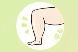 腿粗的致命来源于夏天，吸脂风险过大能否成为主流？图片