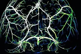 《自然》：大脑消耗能量的场面太震撼了！哈佛华人科学家借助双光子显微镜，首次记录下活体小鼠大脑血流精准调控全过程丨科学大发现图片
