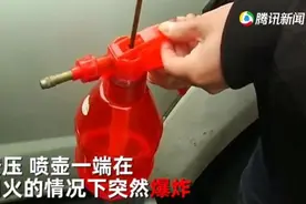 酒精喷壶消毒无明火爆燃！男子眼球险被摘除图片