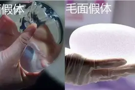 假体隆胸术后和术前乳房手感差别很大吗？图片